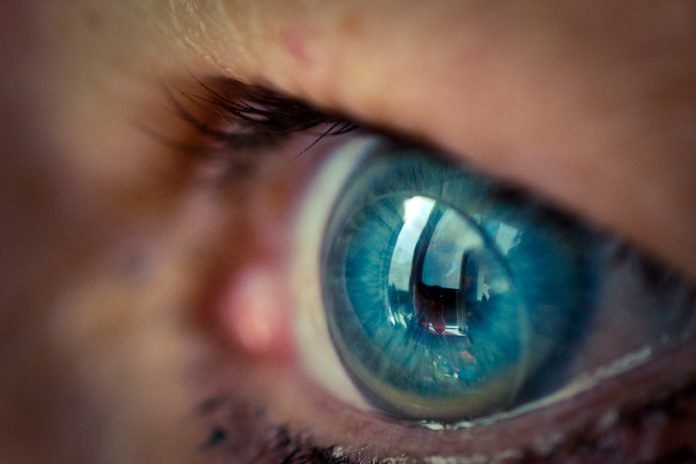 lente lentes contato