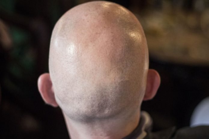 careca