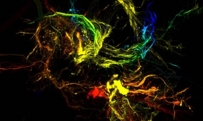 Nanoparticula