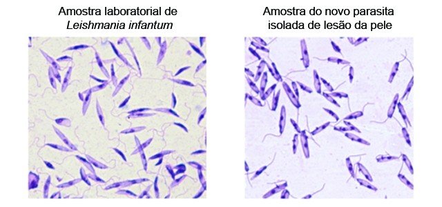 Parasita