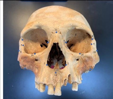 Cranio