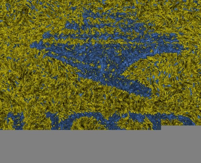Bacteria