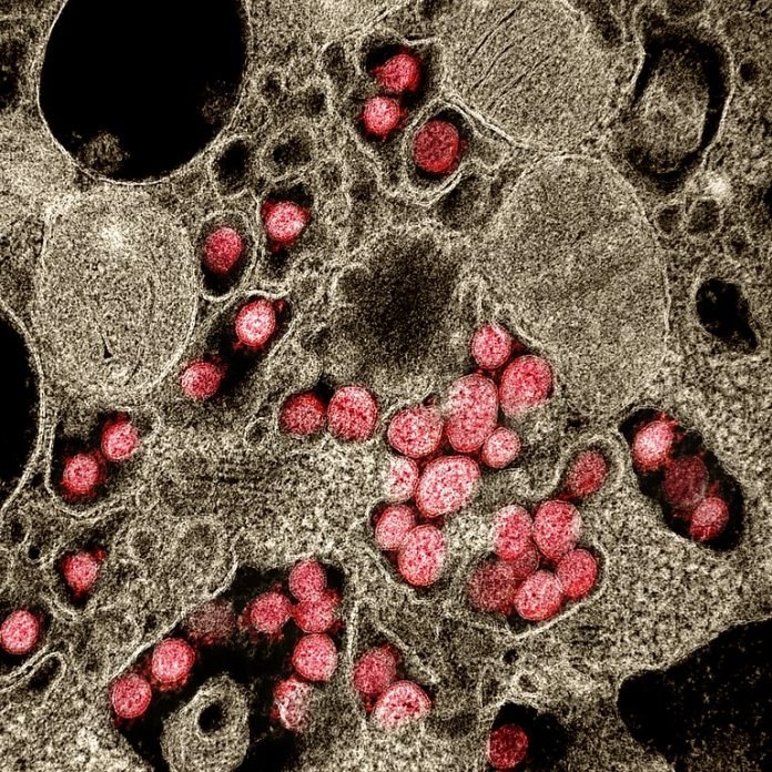 Coronavirus