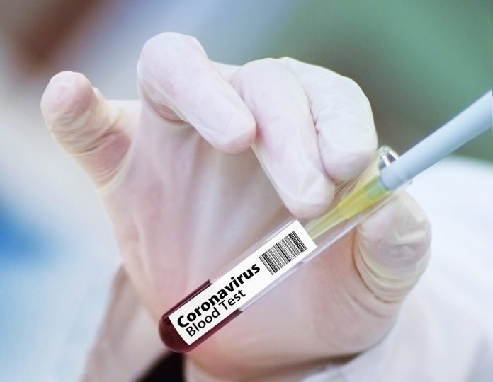 vaccine-4946480_1280