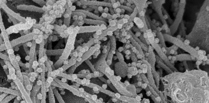 Filopodia