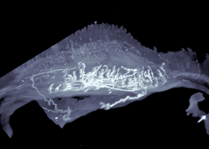 Intestino