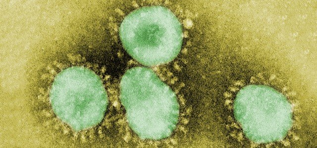 Virus