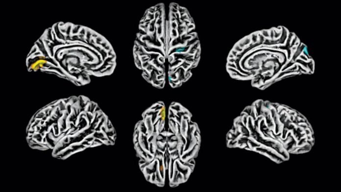 Cerebro