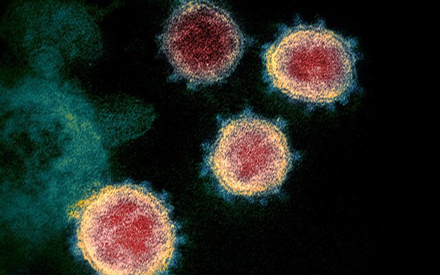 Virus
