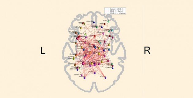 Cerebro