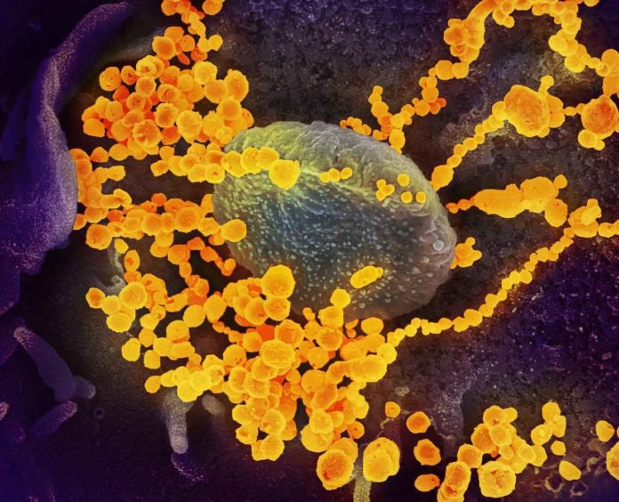 Virus