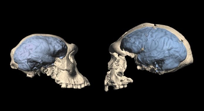 Cerebro1