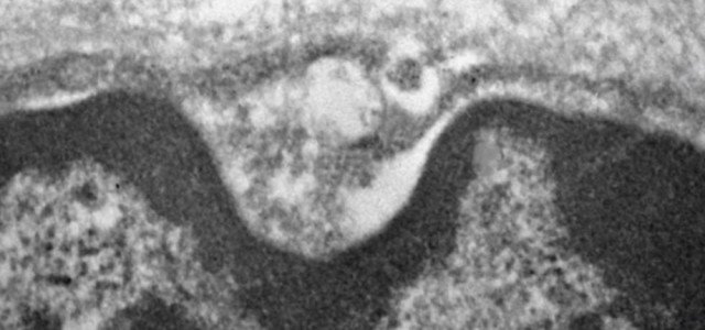 Virus