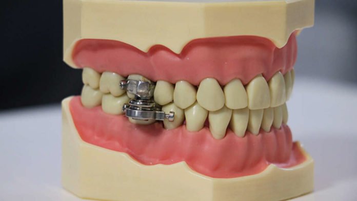 Dentes