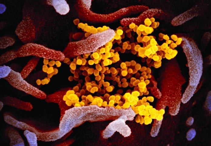 Virus