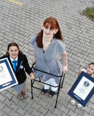 Com 2,15m, turca entra para o Guinness como mulher mais alta do mundo