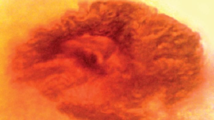 Protozoario