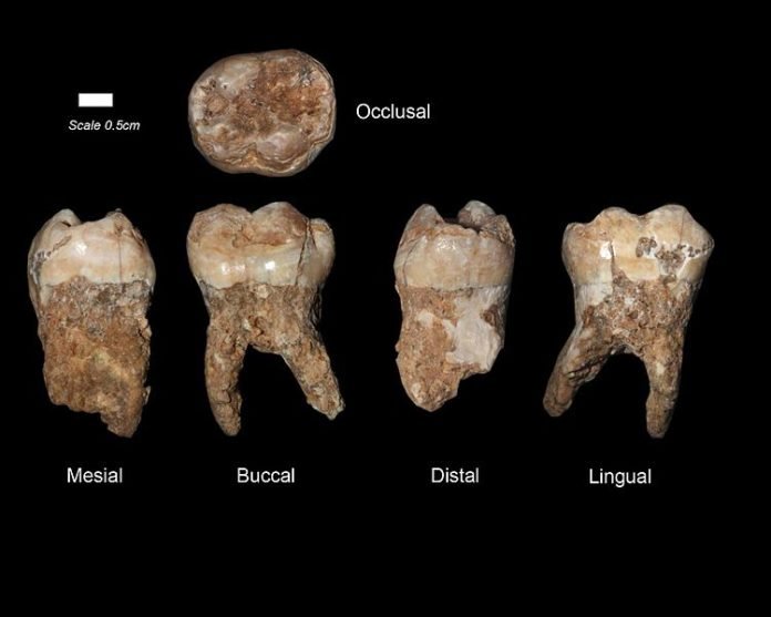 Dentes