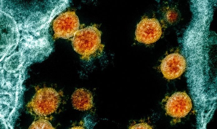 Coronavirus