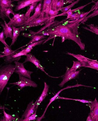 Pesquisadores desenvolvem nanopartículas porosas para medicina regenerativa