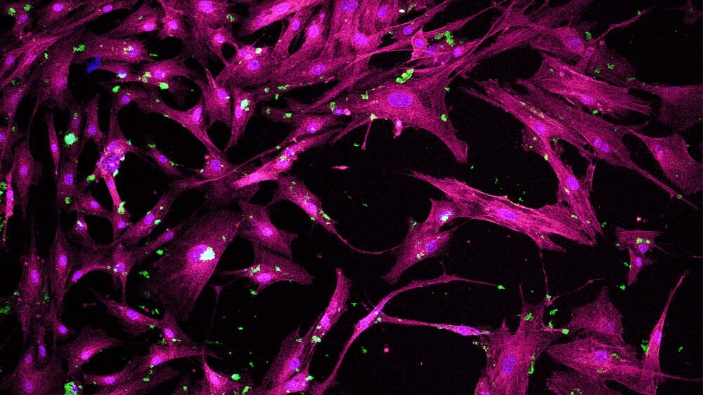 Pesquisadores desenvolvem nanopartículas porosas para medicina regenerativa